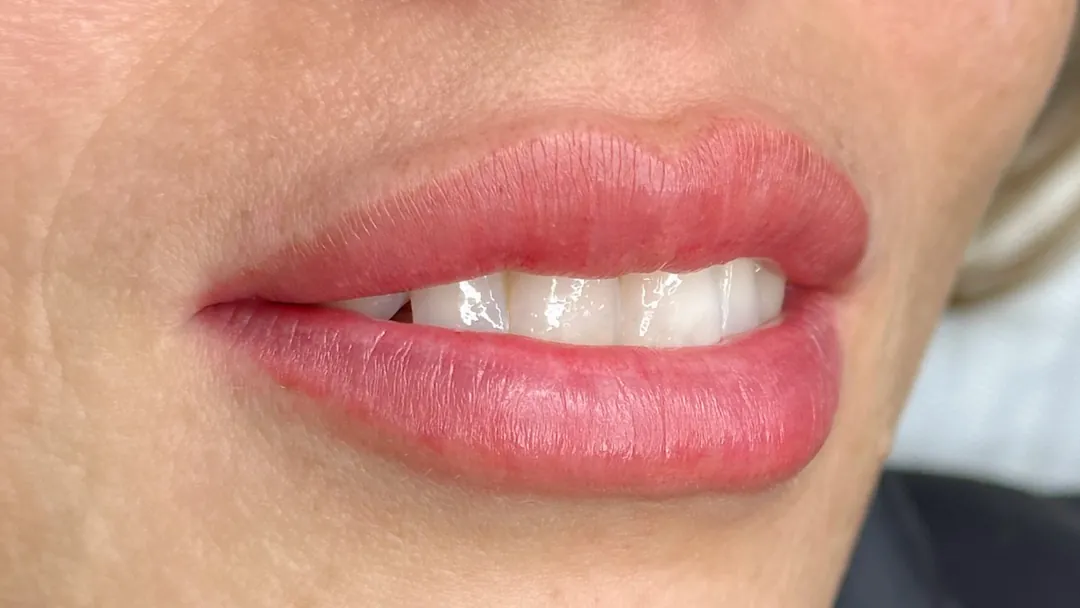 Lip Blush result: naturally rosy, defined lips