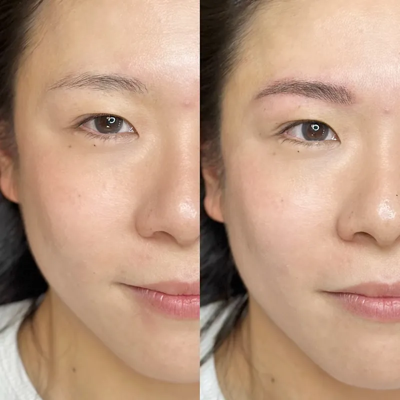 Nanoblading before and after: brows redrawn into a defined, even shape